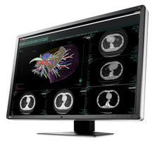 Načíst obrázek do prohlížeče Galerie, EIZO 6-MEGAPIXELOVÝ LÉKAŘSKÝ MONITOR RX660 RadiForce