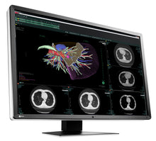 Načíst obrázek do prohlížeče Galerie, EIZO 6-MEGAPIXELOVÝ LÉKAŘSKÝ MONITOR RX660 RadiForce