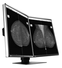 Charger l'image dans la visionneuse de galerie, MONITEUR MÉDICAL EIZO 5 MÉGAPIXELS GX560-MD RadiForce