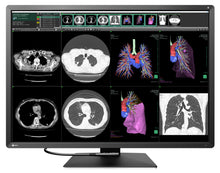 Cargar imagen en el visor de galería, MONITOR MÉDICO EIZO DE 12 MEGAPÍXELES RX1270 RadiForce