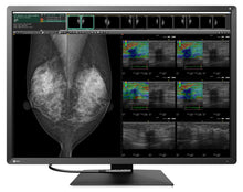 Cargar imagen en el visor de galería, MONITOR MÉDICO EIZO DE 12 MEGAPÍXELES RX1270 RadiForce