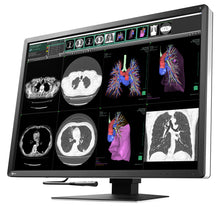 Cargar imagen en el visor de galería, MONITOR MÉDICO EIZO DE 12 MEGAPÍXELES RX1270 RadiForce