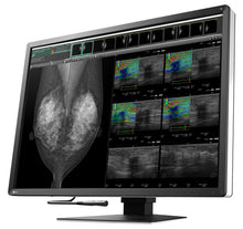 Cargar imagen en el visor de galería, MONITOR MÉDICO EIZO DE 12 MEGAPÍXELES RX1270 RadiForce