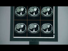 Video laden en afspelen in Gallery-weergave, Jusha C270G 2MP Color Medical Diagnostic Display