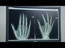 Charger et lire une vidéo dans la visionneuse de galerie, Jusha CR240G Clinical Display