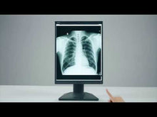 Video laden en afspelen in Gallery-weergave, Jusha M550 Medical Grayscale Breast Diagnosis Display