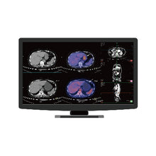 Charger l'image dans la visionneuse de galerie, Jusha CR22 Clinical Display