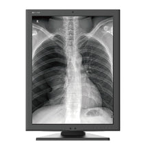 Cargar imagen en el visor de galería, Jusha M260G 2M Medical Grayscale Diagnostic Display