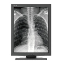 Cargar imagen en el visor de galería, Jusha M270 2MP Medical Grayscale Diagnostic Display
