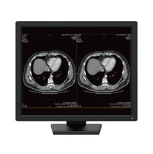 Load image into Gallery viewer, Jusha R190 Medical Display