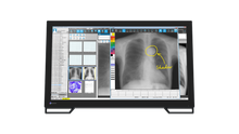 Load image into Gallery viewer, EIZO 2-MEGAPIXEL MEDICAL TOUCH MONITOR MS236WT-A RadiForce
