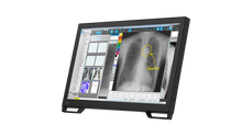 Load image into Gallery viewer, EIZO 2-MEGAPIXEL MEDICAL TOUCH MONITOR MS236WT-A RadiForce
