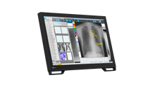 Load image into Gallery viewer, EIZO 2-MEGAPIXEL MEDICAL TOUCH MONITOR MS236WT-A RadiForce
