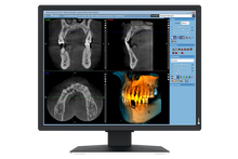 Load image into Gallery viewer, EIZO 2-MEGAPIXEL MEDICAL MONITOR MX217-SB RadiForce
