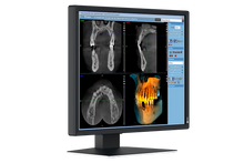 Load image into Gallery viewer, EIZO 2-MEGAPIXEL MEDICAL MONITOR MX217-SB RadiForce
