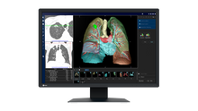 Afbeelding in Gallery-weergave laden, EIZO 2-MEGAPIXEL MEDISCHE MONITOR MX243W RadiForce
