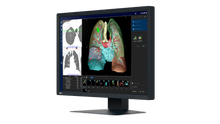 Afbeelding in Gallery-weergave laden, EIZO 2-MEGAPIXEL MEDISCHE MONITOR MX243W RadiForce
