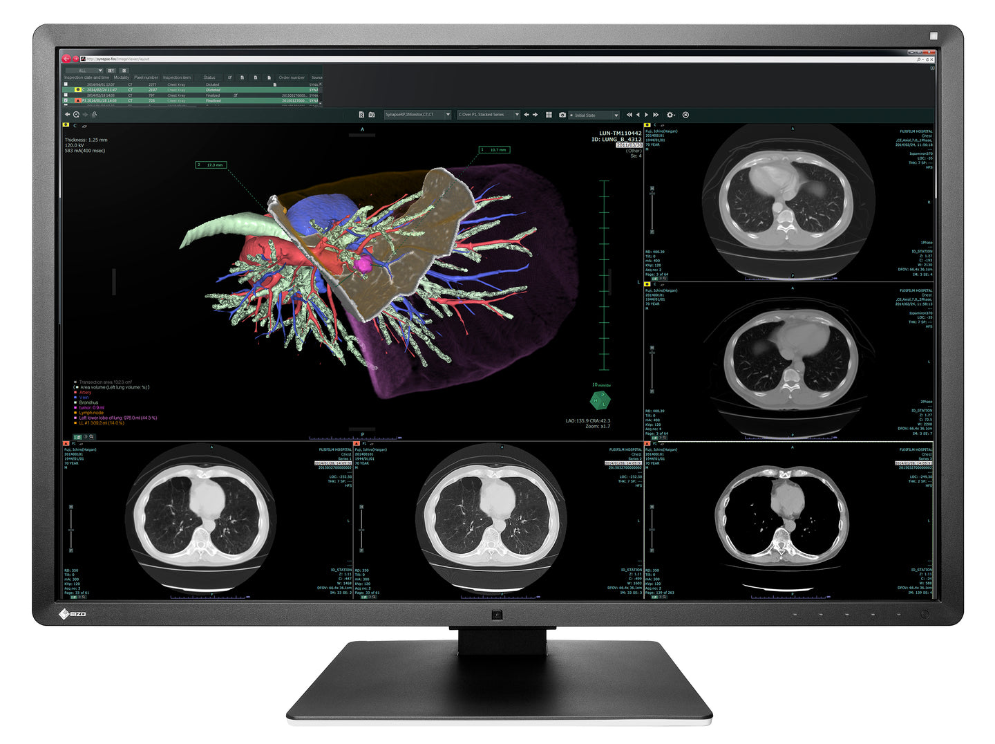 EIZO 6-MEGAPIXEL MEDICAL MONITOR RX660 RadiForce