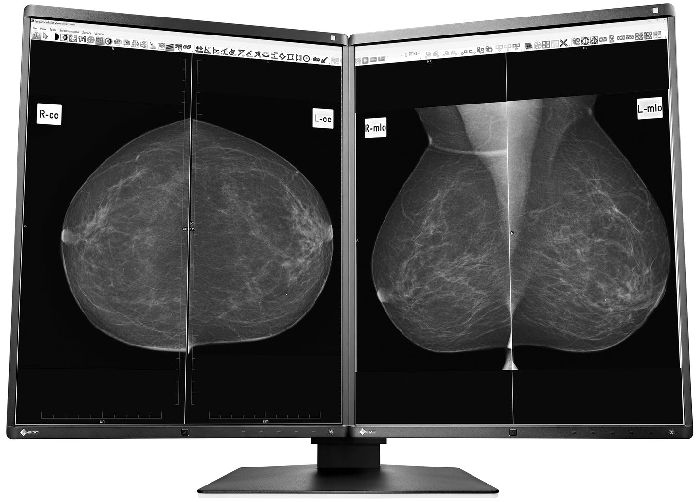 EIZO 5-MEGAPIXEL MEDICAL MONITOR GX560-MD RadiForce