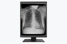 Load image into Gallery viewer, EIZO 3-MEGAPIXEL MEDICAL MONITOR RX370 RadiForce
