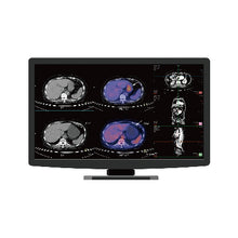 Load image into Gallery viewer, Jusha CR22 Clinical Display
