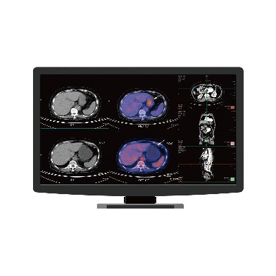 Jusha CR22 Clinical Display