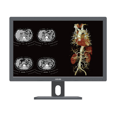 Jusha CR240G Clinical Display