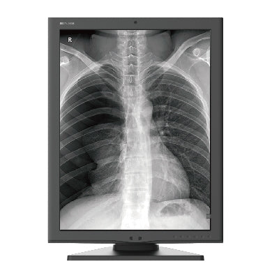 Jusha M260G 2M Medical Grayscale Diagnostic Display