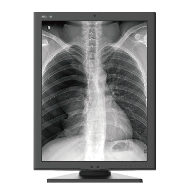 Jusha M270 2MP Medical Grayscale Diagnostic Display